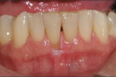 gg1